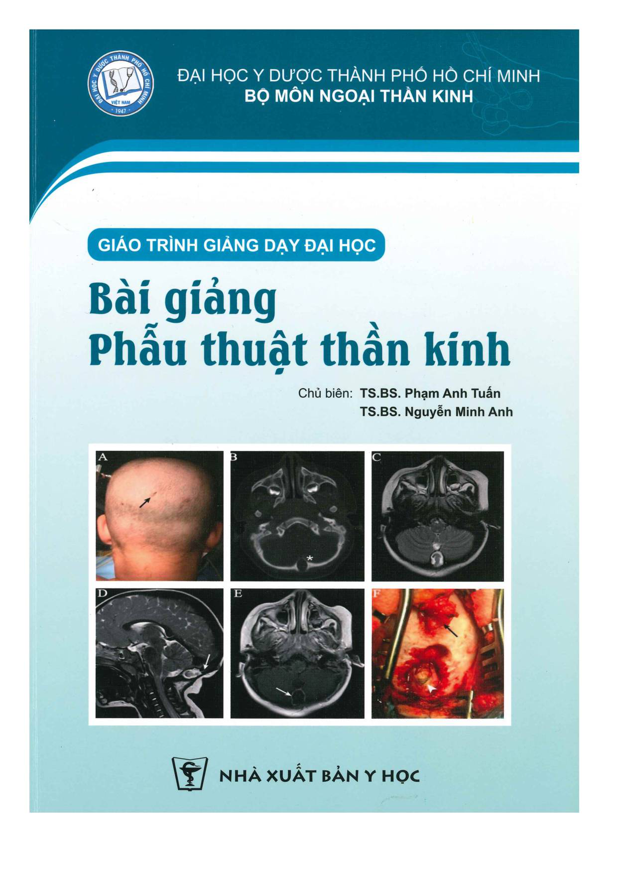 Giáo trình Bài giảng phẫu thuật thần kinh