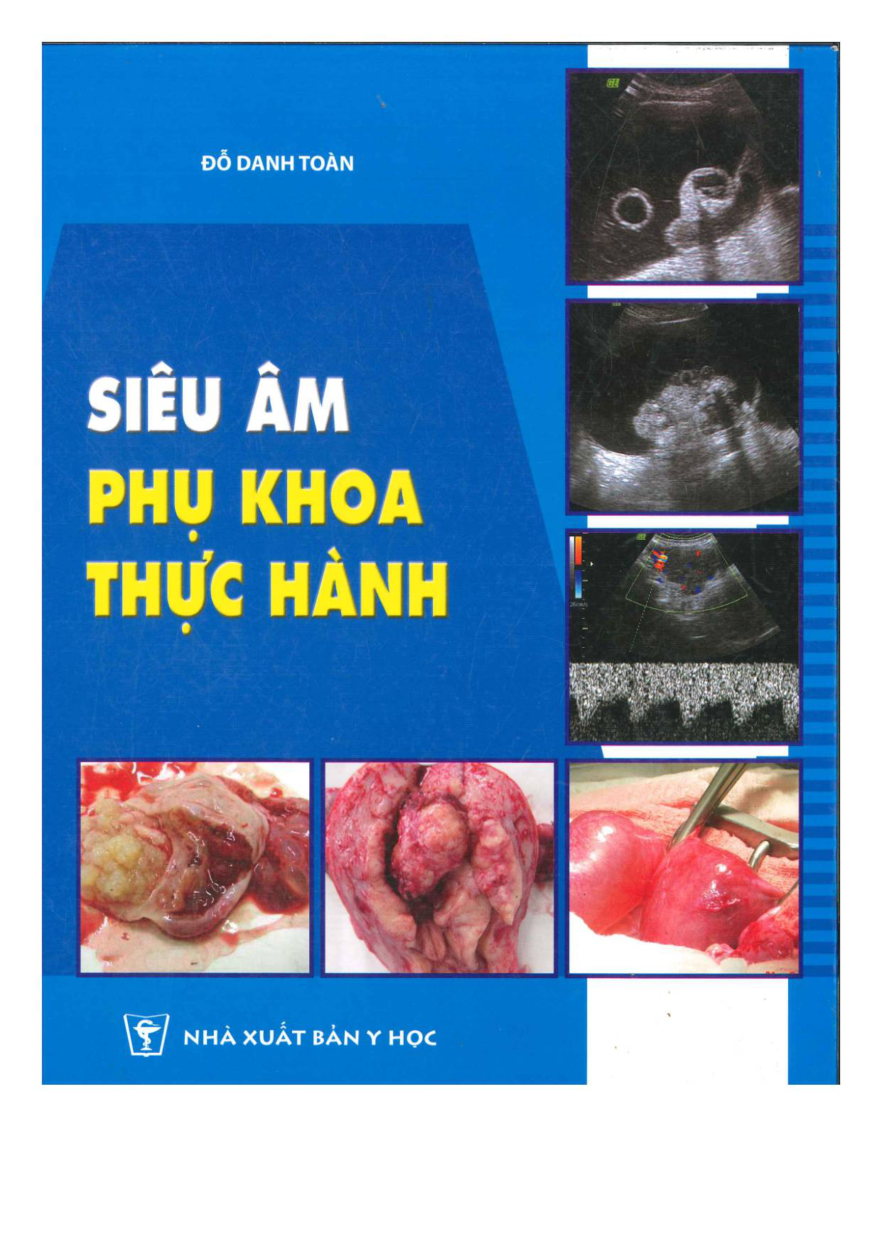 Siêu âm phụ khoa thực hành