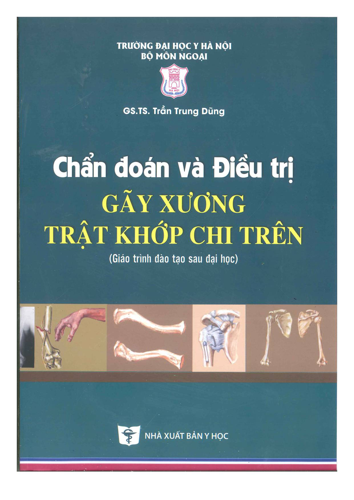 Chẩn đoán và điều trị gãy xương trật khớp chi trên