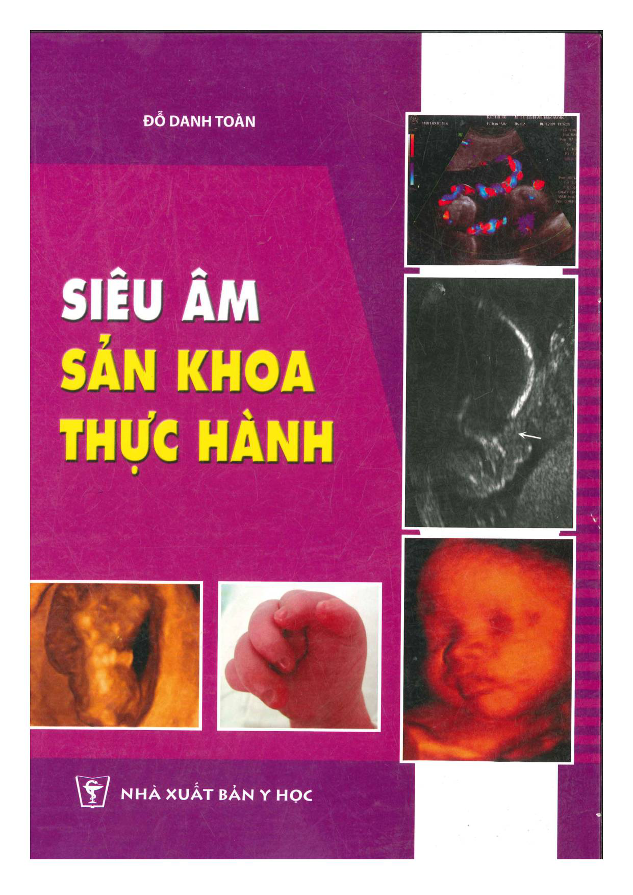 Siêu âm sản khoa thực hành