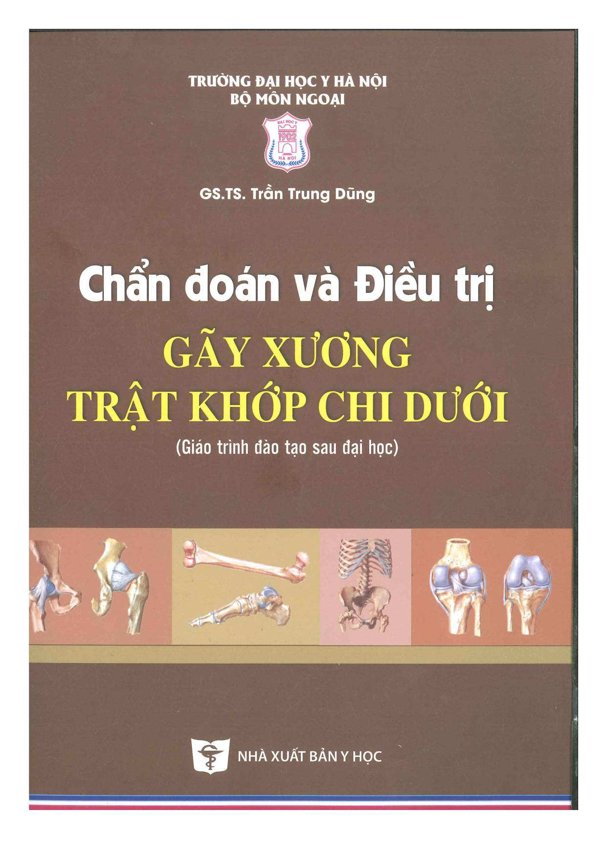 Chẩn đoán và điều trị gãy xương trật khớp chi dưới